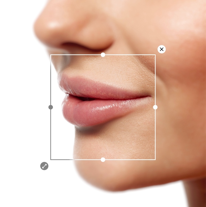 Lip Fillers 101: What to Know Before You Enhance Your Look